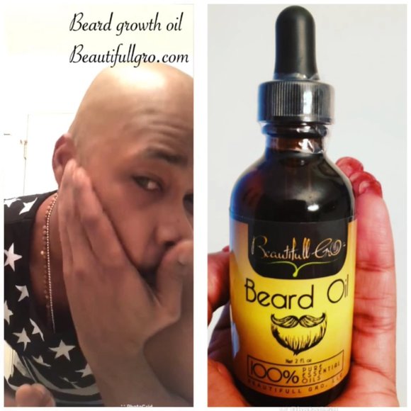100% Natural Beard Regrowth Oil - Picture 2 of 4